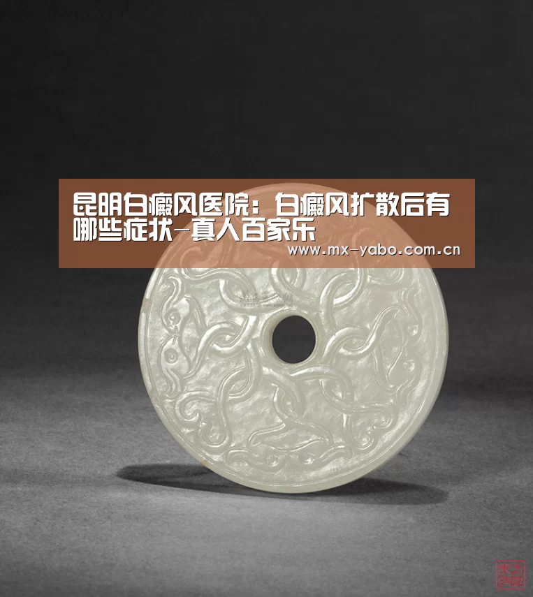 昆明白癜风医院:白癜风扩散后有哪些症状-真人百家乐(图4) 真人百家乐